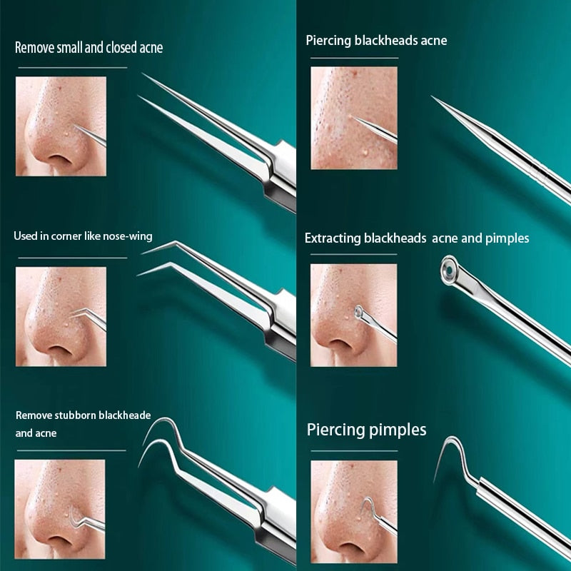 SkinSculpt-kit | Verzorgingsset voor het verwijderen van mee-eters